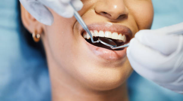 Best Broken Tooth Emergency  in Spring Glen, UT